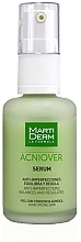 Preventive Facial Serum - Martiderm Acniover Serum — photo N26