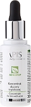 Fragrances, Perfumes, Cosmetics Face Concentrate - APIS Professional Concentrate For Acne Skin