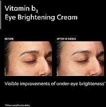 Brightening Eye Cream - PCA Skin Vitamin B3 Eye Brightening Cream — photo N5