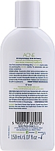 Cleansing Tonic - Novaclear Acne Toner — photo N2