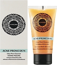 Cleansing Peeling for Oily, Combination and Acne-Prone Skin - Vipera Cos-Medica Acne-Prone Skin Derma-Peeling — photo N2