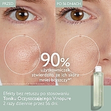 Face Tonic - Caudalie Vinopure Clear Skin Purifying Toner — photo N14