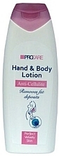Fragrances, Perfumes, Cosmetics Anti-Cellulite Hand & Body Lotion - Aries Cosmetics ProCare Anti-cellulite Hand & Body Lotion