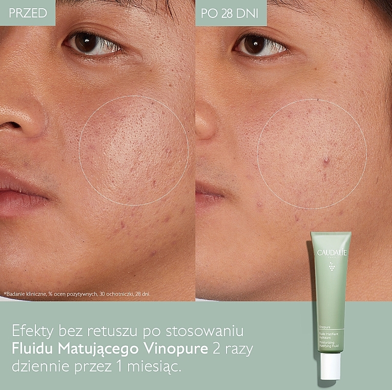 Mattifying Face Fluid - Caudalie Vinopure Skin Perfecting Mattifying Fluid — photo N26