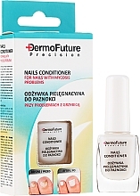Antifungal Nail Treatment - DermoFuture Course Of Ttreatment Against Nail Fungus — photo N1